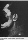 Badekur des Proleten
